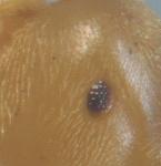 oeil